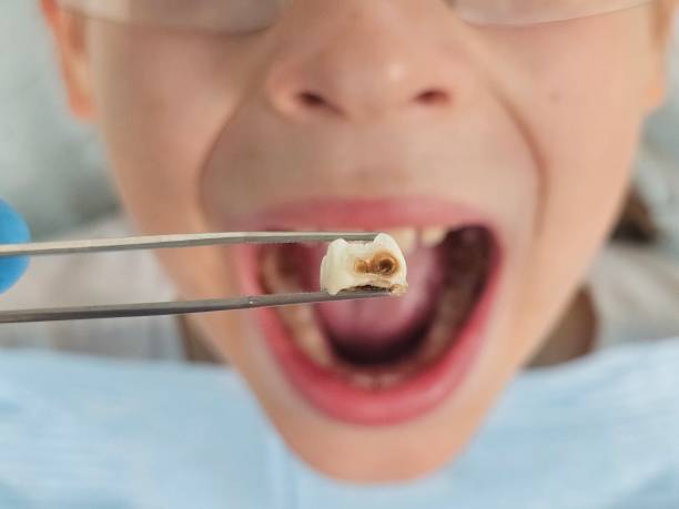 Best Emergency Pediatric Dental Care in Oakville, MO